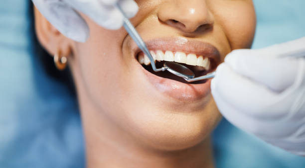 Best Pediatric Emergency Dentist in South Rosemary, NC