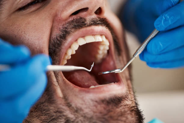 Best Pediatric Emergency Dentist in South Rosemary, NC